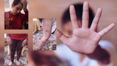 «عُذّب ليومٍ كامل».. اختطاف فتى سوري في لبنان على يد رب عمله