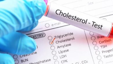 cholesterol-test