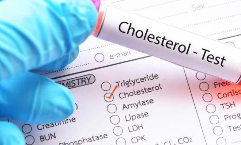 cholesterol-test