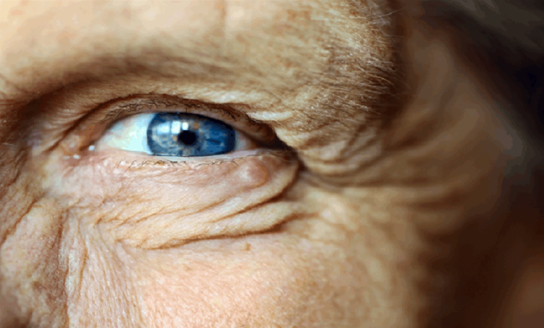 متلازمة بنسون.. علامة مبكرة على الخرف تظهر في العين قبل فقدان الذاكرة !